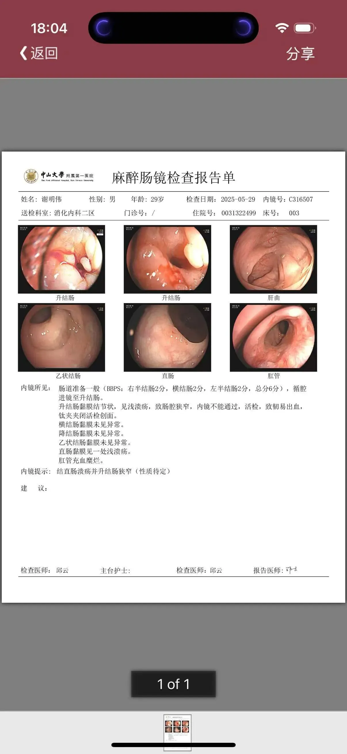 麻醉肠镜检查报告单